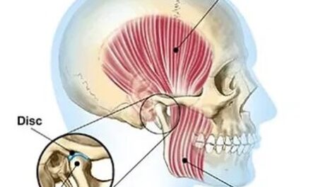 Is Your Jaw Giving You a Headache?