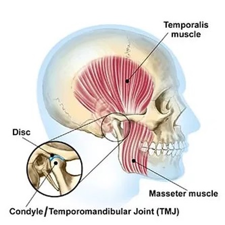 Is Your Jaw Giving You a Headache?